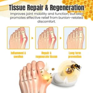 Ceoerty™ HalluxCure Bee Venom Relief Cream