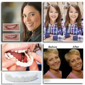 DIYSTAR™ Adjustable Snap-On Dentures