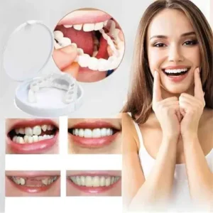 DIYSTAR™ Adjustable Snap-On Dentures