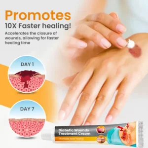 Histone™ Diabetic Wounds Treatment Cream