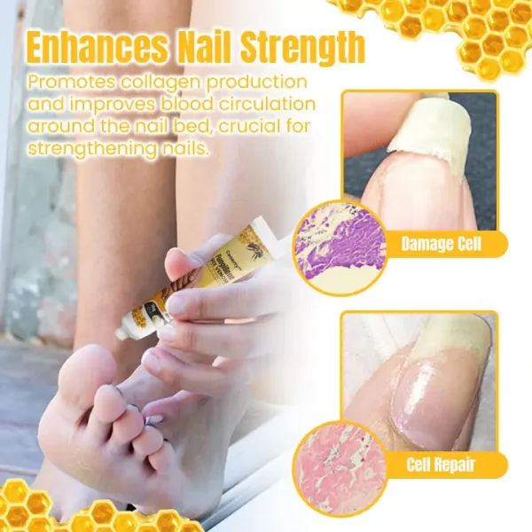 Ceoerty™ FungiGone Bee Venom Nail Cream