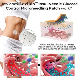 Lovilds™ InsuliNeedle Glucose Control Microneedling Patch