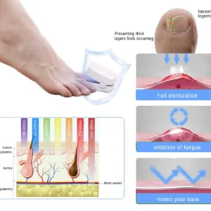 QIAWI™ Revolutionary High-Efficiency Light Therapy Device For Toenail Diseases