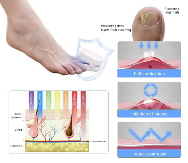 QIAWI™ Revolutionary High-Efficiency Light Therapy Device For Toenail Diseases