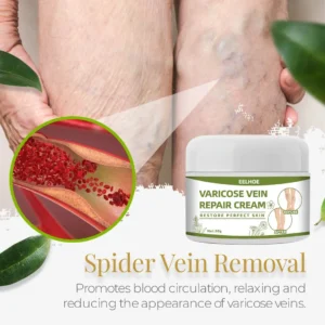 Varicose™ Vein Repair Cream (Point AAD Recommended) for Varicose Vein Removal, Spider Veins